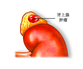 9d41d2fd9f3442ea83bcab67b8272f12.png