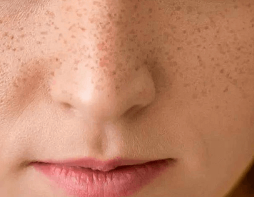 f18a77573bcd4757ab7c45f17eb0be7b.png