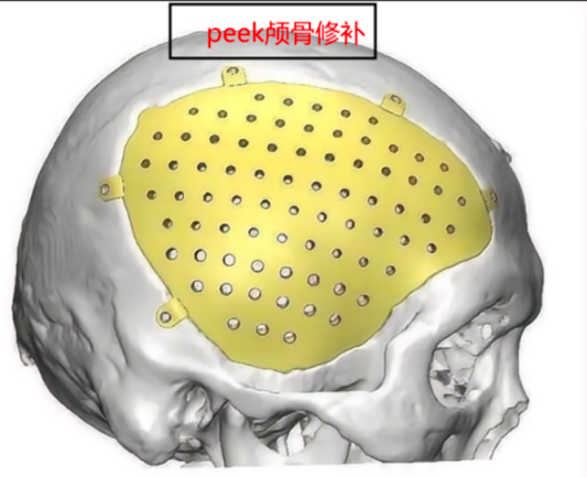 96a065ef70524b0f80739dc7060cf755.png